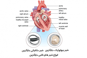 شیر های قلبی جایگزین ( کلاس III کالای پزشکی )